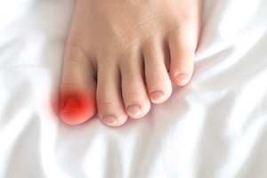 How Did I Develop an Ingrown Toenail?